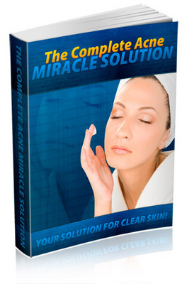 Product picture The Complete Guide To Safe, Easy And Permanent Acne Relief!